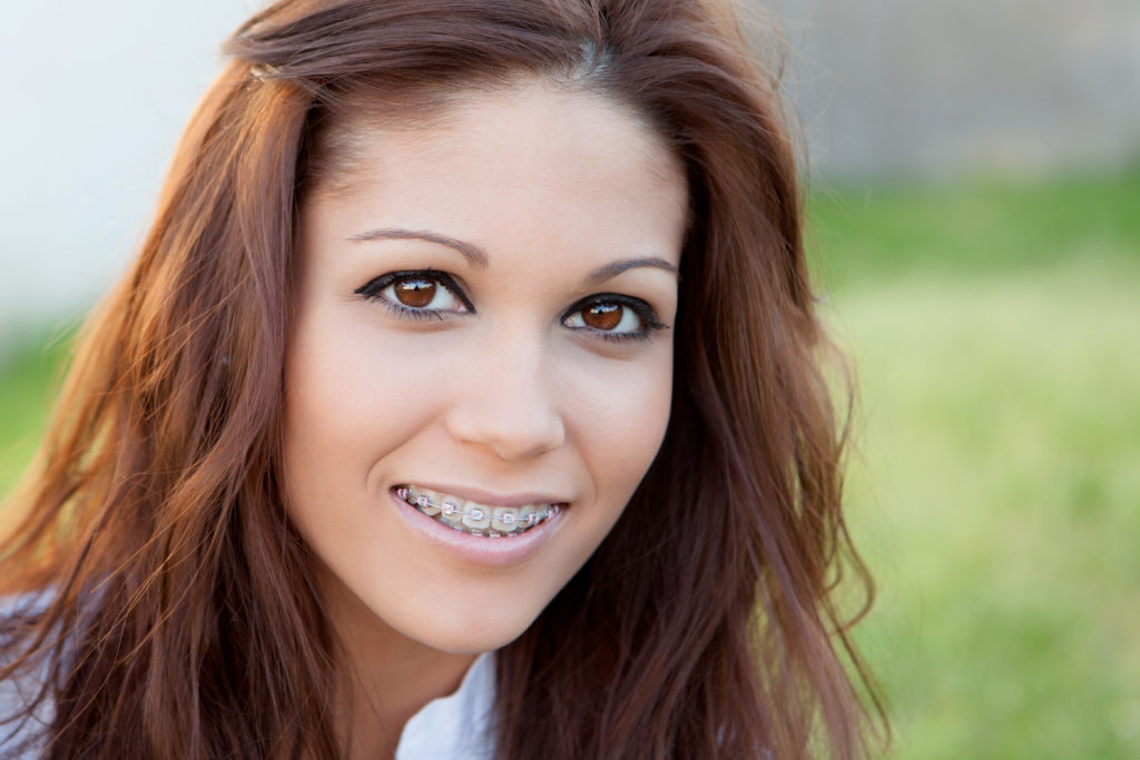 Braces for Adults in Colorado Springs, CO Bailey Orthodontics